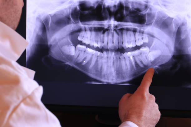Best Cracked Tooth Emergency Dentist  in Prceton, IN