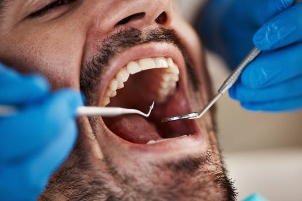 Best Emergency Dental Filling Replacement  in Prceton, IN